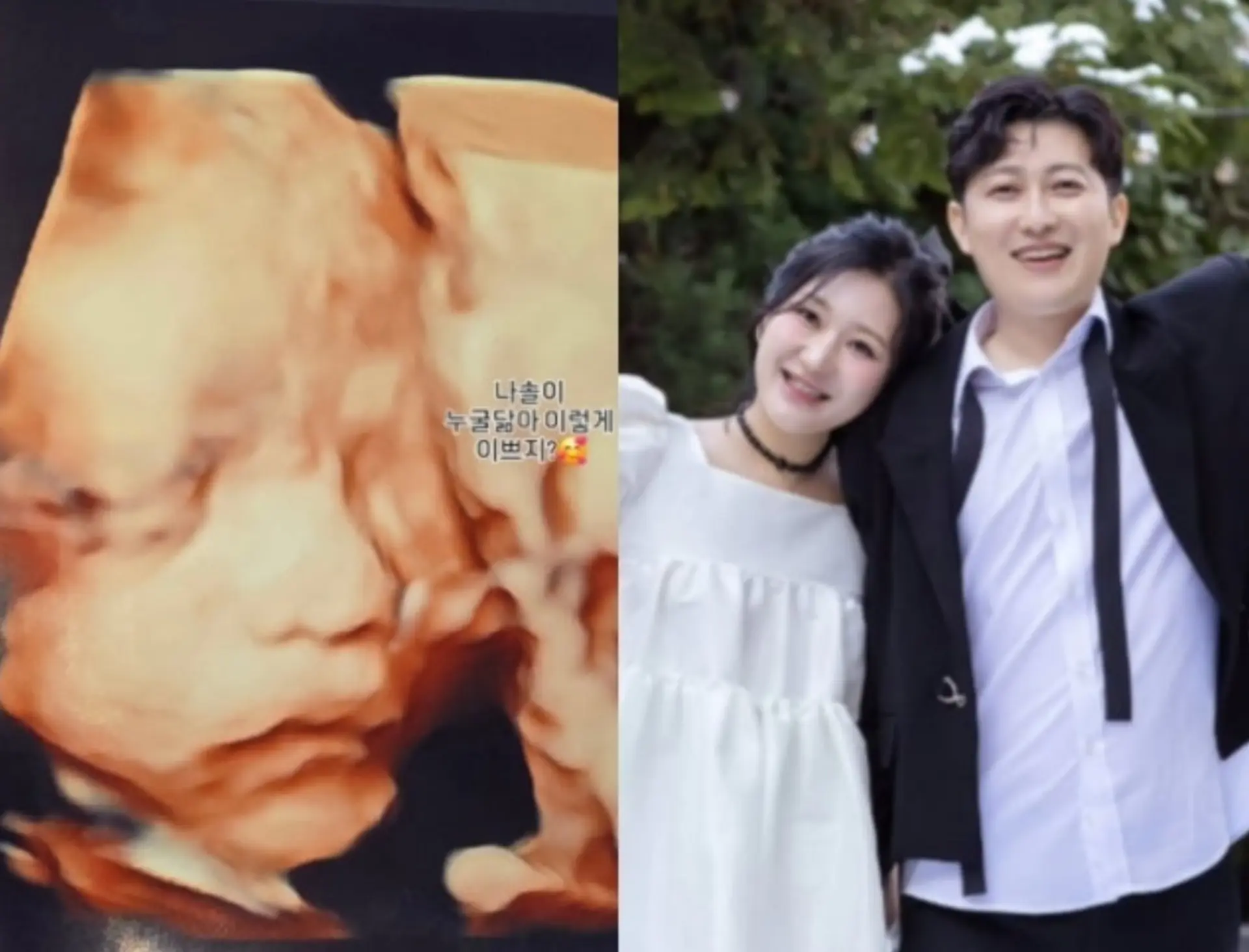 '나는솔로' 28기 정숙, 2세 초음파 공개… "벌써 완성형 미모"