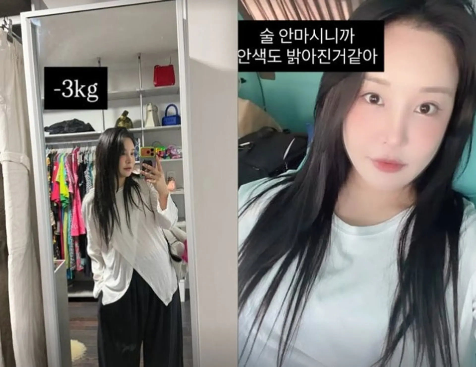 "인형 비주얼"…랄랄, 성형·-3kg 감량 후 달라진 근황