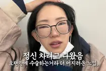 “一生只有一次”……崔俊熙，公开整形手术后肿胀的脸