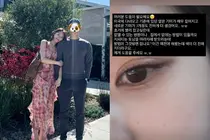 'Heart Signal 4' Kim Ji-min, setelah kembali dari Amerika, kulitnya darurat... mengungkapkan flek yang semakin gelap