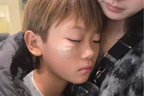 Lee Dong-guk♥Lee Soo-jin's son, Sian, receives 6 stitches for facial injury... Heart-stopping experience for the couple raising five children