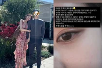 'Heart Signal 4' Kim Ji-min, Skin Emergency After Trip to the U.S.... Darkening Freckles Revealed