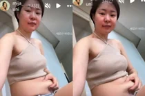 '장광 딸' 미자, 몰라보게 늘어난 뱃살…충격의 실시간 눈바디
