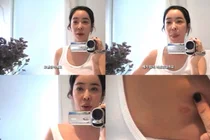 이혜영, 폐암 수술 흉터 첫 공개…