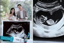 김준호·김지민 부부, 결혼 1년 만에 2세 소식… 