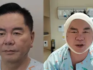 '영구' 심형래, 안면거상 재수술 후 모습 공개...팬들 위해 얼굴 리모델링 결단
