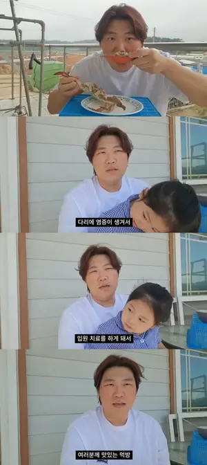'홍현희 시매부' 천뚱, 다리 염증 입원 고백…헬쑥해진 근황