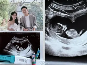 김준호·김지민 부부, 결혼 1년 만에 2세 소식… 