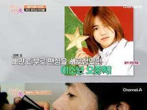  '뷰티클리닉 터치미' 11회 클릭비 오종혁 출연… 여드름 흉터 고민 조명