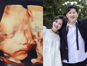 'I Am SOLO' Season 28 Jeong-sook, Reveals 2D Ultrasound... 'Already a Perfect Beauty'