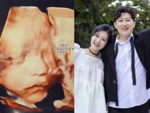 'I Am SOLO' Season 28 Jeong-sook, Reveals 2D Ultrasound... 'Already a Perfect Beauty'