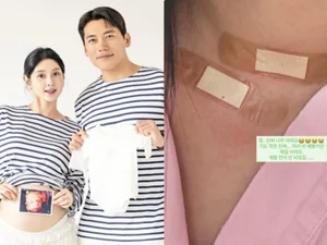 'I'm Solo' Season 6 Young-sook, Diagnosed with Thyroid Cancer… 