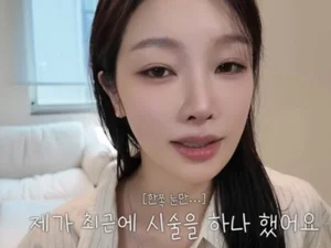 'Transit Love Season 4' Park Ji-hyun regrets after lower-eye fold procedure…her partner Jeong Won-gyu also complained