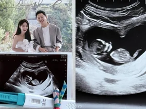 김준호·김지민 부부, 결혼 1년 만에 2세 소식… 