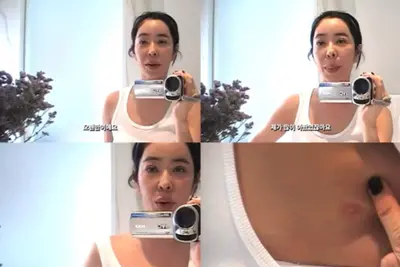 이혜영, 폐암 수술 흉터 첫 공개…