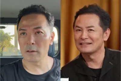 '소통 강사' 김창옥, 퉁퉁 부은 붉은 얼굴 공개… 옻칠 작업 여파 가능성 눈길