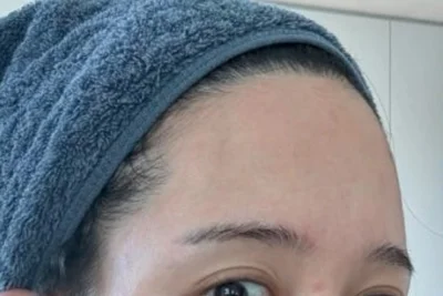 「ホルモンの奴隷」ナム・ボラ、妊娠後に変わった肌…苦悩を語る