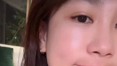 ‘김준호♥’ 김지민, 욕실 낙상사고… 