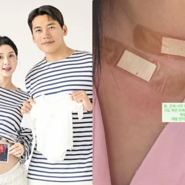 《我是 SOLO》6期的英淑，确诊甲状腺癌… 