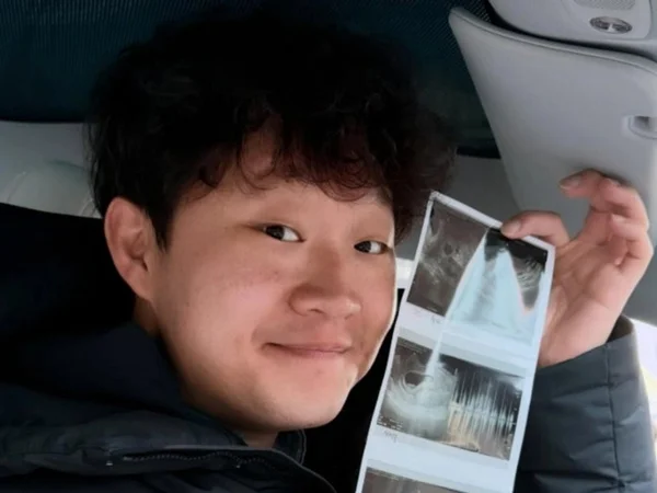 IQ 134 '피식대학' 정재형, 아빠 된다…상위 1% 유전자 화제