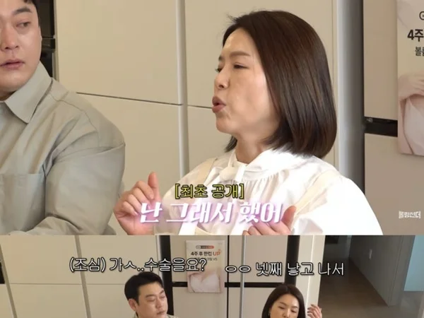 김지선·이세영·제시, 스타들의 거침없는 가슴 성형 고백… 