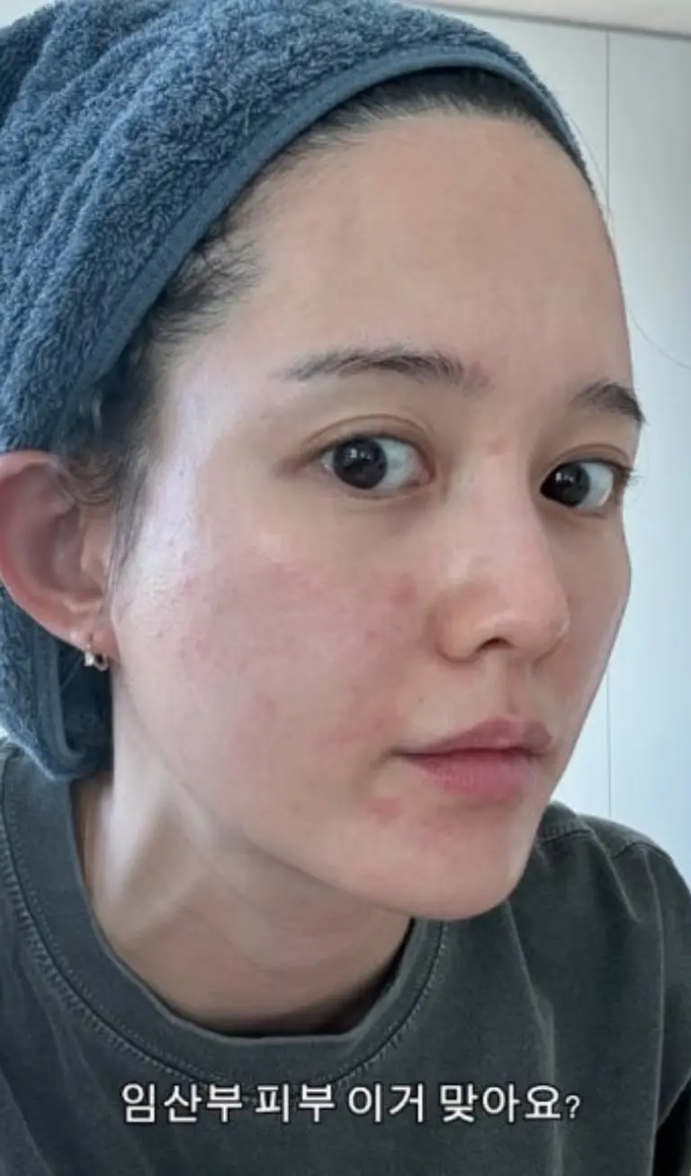 남보라 임신 근황