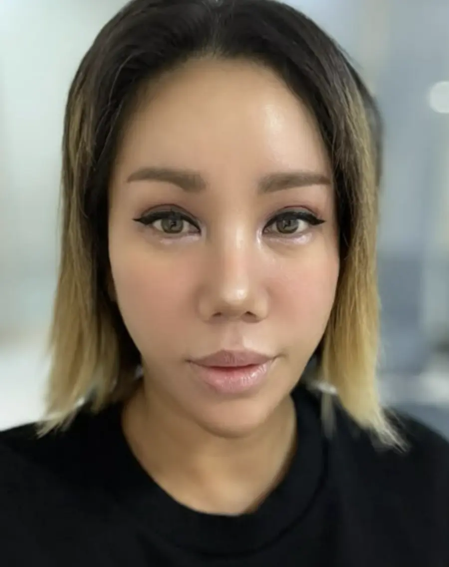 김송