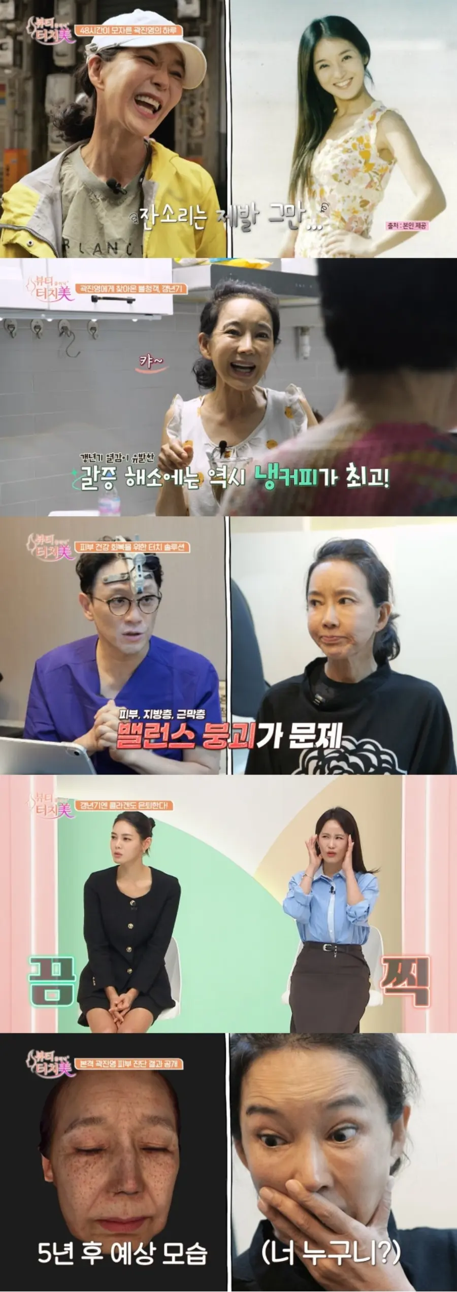 채널A '뷰티 클리닉 터치미'